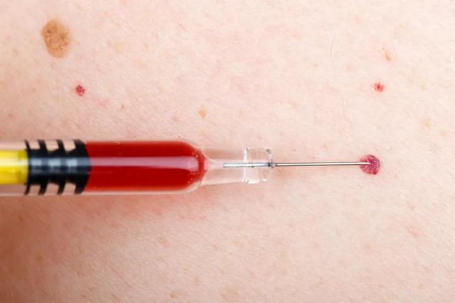 皮肤上出现很多小红点 皮肤上出现很多小红点