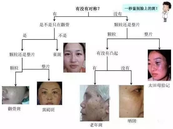 脸上皮肤脂溢性角化斑