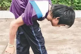 海归博士谢绝美国医院高薪，回国后做“驼背”手术3000多例图片