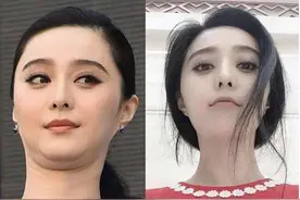 明星都摆脱不掉的双下巴，这2种双下巴可以试试这样缓解图片