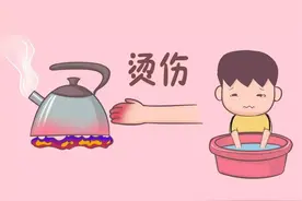 夏天里有一种常见的意外伤害，烧伤该怎样护理？图片