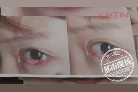 想要眼睛更大，女子整形术后悔不当初：“我现在哭都不敢哭！”图片