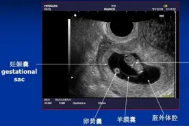 怀孕多少天从哪天开始算？不是同房日不是查出那天，看医生怎么算图片