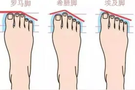 为什么第二脚趾比第一脚趾长的人叫希腊脚，这类人会不孝顺吗？图片