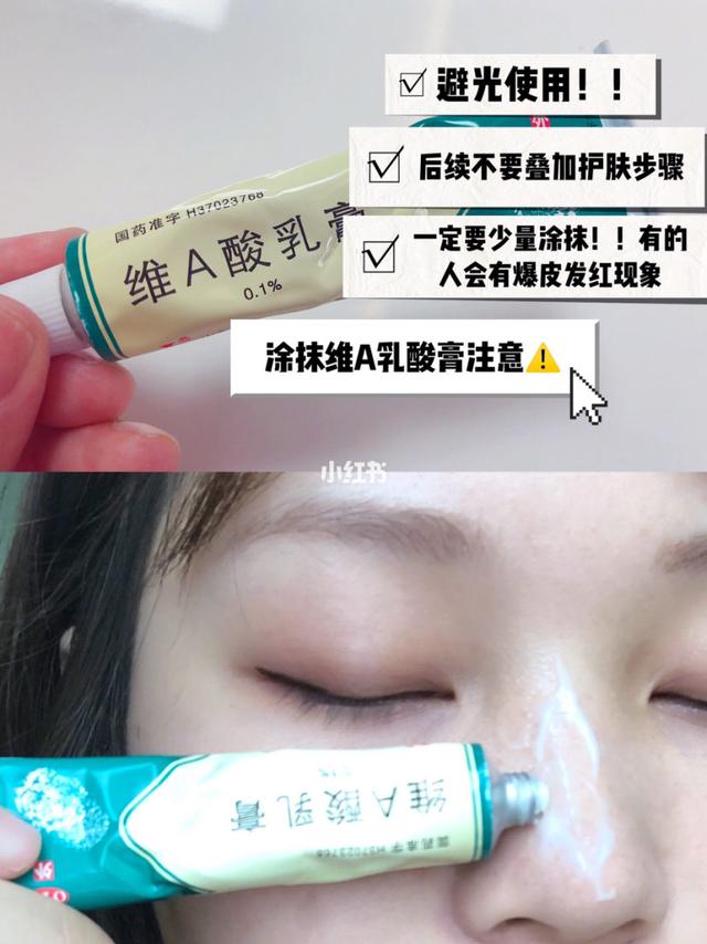 激光去毛周角化症多少钱