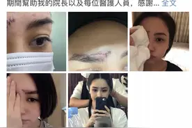 39岁阿娇晒受伤照，伤口6厘米，看到霍汶希反应，网友：暖心！图片