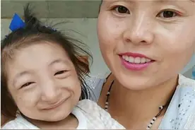 美国女孩天生有4条腿，从小备受家人呵护，婚后被丈夫宠成公主图片