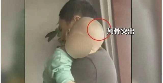 郴州“大头娃娃”事件再解析：不只倍氨敏，这些产品也可能有害