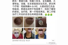 案例分享｜失眠！可以拒绝吃安眠药，脐灸来帮帮你图片