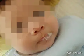 婴儿爱吐泡泡，竟是得了肺炎图片