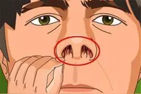 男性的鼻毛为何会“窜”出来？鼻毛旺盛代表着什么？图片