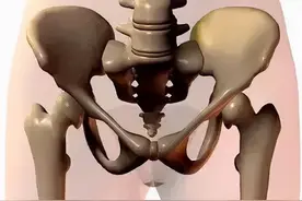 骨盆不正的问题正在危害我们的身体！你该了解一下自己的骨盆了图片