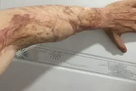 湖南老妇去医院看病，满臂伤疤吓得医生报警，才知她是抗日英雄图片