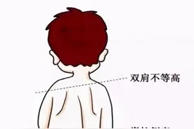 小孩有脊柱侧弯怎么办？图片