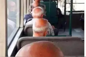 为啥很多秃头的人宁愿留周围一圈头发也不剃成光头呢？图片