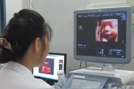 四维彩超不只看宝宝的“颜值”，检查时的注意事项，准妈妈需牢记图片