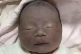90后宝妈产下“黑脸”宝宝，皮肤黝黑如“包公”，90天后成功逆袭图片