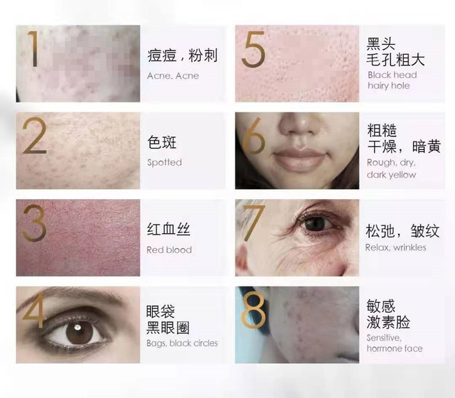 鑳跺師铔嬬櫧绌剁珶鏄€滄櫤鍟嗙◣鈥濊繕鏄編瀹瑰湥鍝侊紵鎴戜滑鐢ㄦ渶鏉冨▉鐨勮瘉鎹璇? onerror=