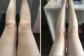 脂肪腿、肌肉腿、水肿腿的救星！这样的瘦腿训练效果最好图片