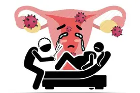 体内有癌，月经先露破绽？经期有3种“怪象”，尽快去医院排查HPV图片