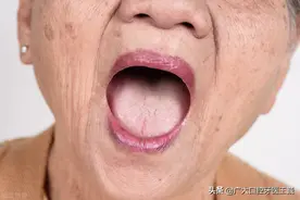 日式“无种植”仿生牙究竟是什么？老年人不用再受缺牙之苦？图片