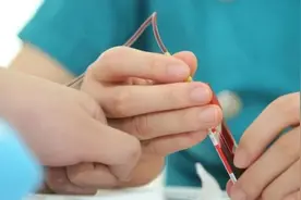 血常规选扎手指还是抽血？两者有什么区别？图片