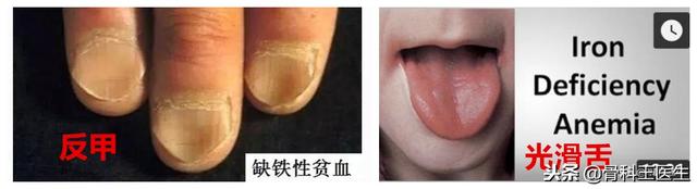 思想不集中怎么办
