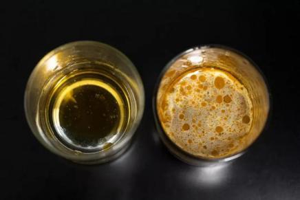 这条打底裤堪称裤子界小米，燃脂提臀还滋润身体，重点是自带磁疗