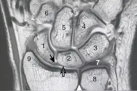 「分享」 解剖：前臂、腕和手的影像学特征图片