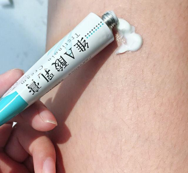 毛周角化可以用果酸身体乳吗