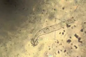 大虾里面有寄生虫不能吃？虾线、虾头、虾皮哪个部位更脏？告诉你图片
