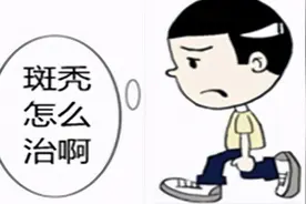 头发成块脱落来的太“秃”然！一夜之间“鬼剃头”图片