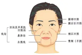 欧洲人羡慕我们不易老？其实，亚洲下垂式衰老更可怕图片
