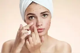 齐齐哈尔时尚：鼻翼长痘怎么调理？涂茶树精油调理鼻翼痘图片