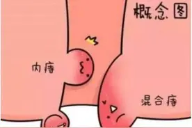 俗话说十女十痔，女性痔疮高发，做好七招可以有效防治图片