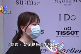 精心准备惊喜，男朋友戴女戒手指脱皮？图片