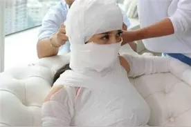 还记得13岁获母亲支持整容的女孩吗？3年整60次，现容貌不能看久图片