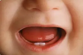 宝宝多大开始长牙？家长该如何护理？这份出牙时间表让你不再焦虑图片