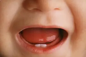 宝宝多大开始长牙？家长该如何护理？这份出牙时间表让你不再焦虑图片