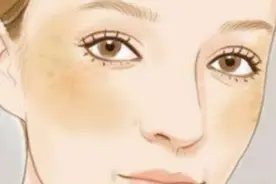 面黄、黄褐斑，拒做“黄脸婆”从三大古方开始，调气血重回好气色图片