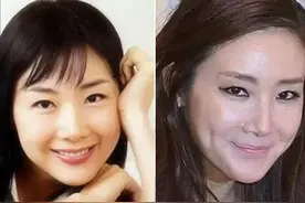 整容后遗症太可怕，6位爆红的初代韩流女演员，如今脸都认不出图片