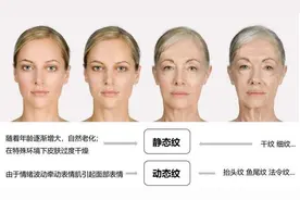 “肽、寡肽、多肽、胜肽”有什么区别，能抗皱淡纹吗？图片
