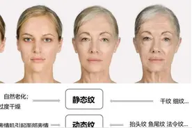 “肽、寡肽、多肽、胜肽”有什么区别，能抗皱淡纹吗？图片