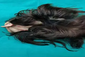 心疼！女子秀丽长发被卷入机器，头皮完全撕脱图片