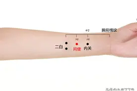间使穴：理气通络，解郁截疟，宁心安神图片