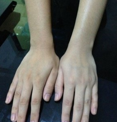 为什么用身体乳会长汗毛吗