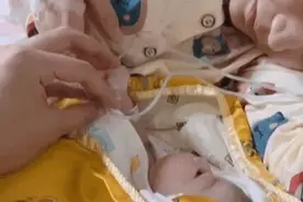 “最豪横”宝宝火了，刚出生就拔妈妈氧气管，网友：拔的有点早了图片