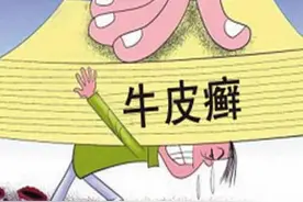 俗称牛皮癣的银屑病，能治愈吗？今天就带你了解中医“解痒”之道图片