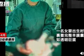 “哪吒”降世？女婴出生时如透明巨蛋，医生这样解释神奇一幕图片