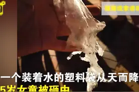 “天降”水球砸中5岁女孩头部，一年内3起高空抛物，业主：嫌孩子们太吵图片